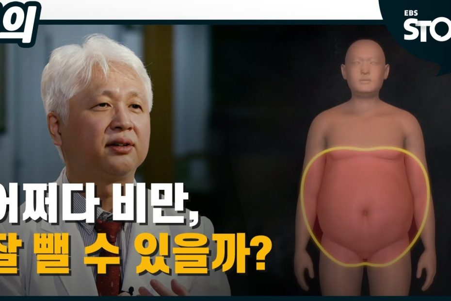 비만대사수술 (위소매절제술) 10일차 후기 : 네이버 블로그