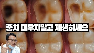 17년차 치과의사가 알려주는 치아재생 기술의 현주소. - Youtube