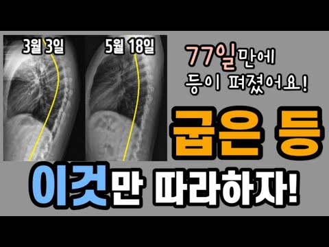 스스로 할 수 있는 굽은등 교정운동(폼롤러,맨몸운동)