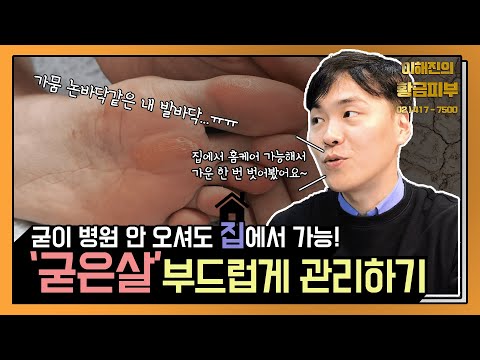 굳은살 칼이나 도구를 이용하지 않고 완벽하게 없애기 / 연세에이앤비 피부과 이해진원장