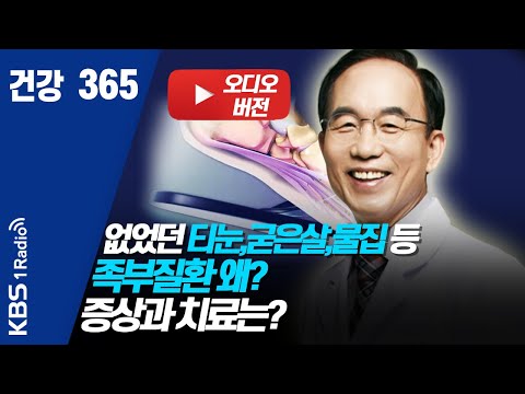 [건강365] 200424 없었던 티눈, 굳은살, 물집 등 족부질환 왜?  증상과 치료는?   #티눈 #물집 #무좀 #족불질환  #발건강  #건강365 #건강