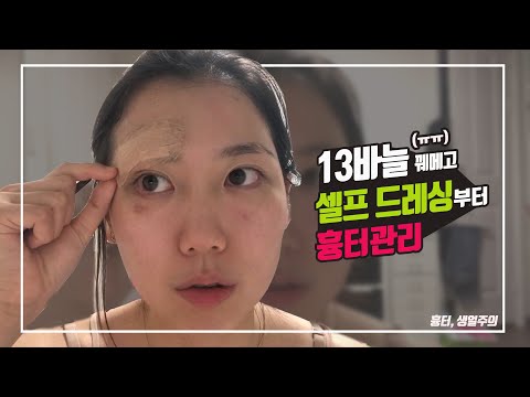 얼굴흉터 관리부터 셀프드레싱 완전정복(메피폼 사용)