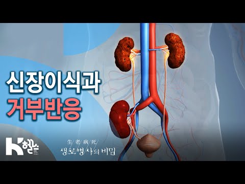 신장이식과 거부반응 - 741회 (20.07.29) 면역이 관용을 허락하는 시간