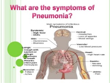 Different Stages Of Pneumonia Diseases And Treatments - Jvc