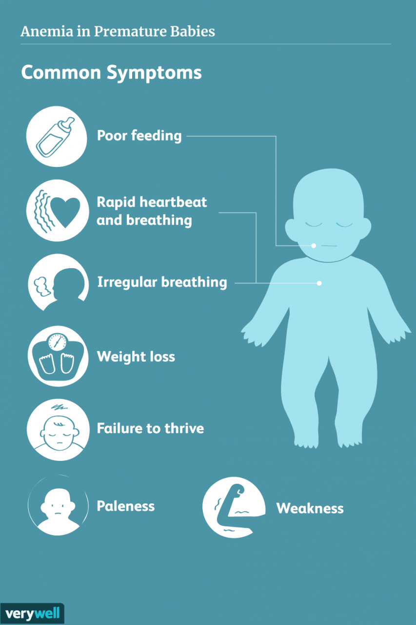 Causes And Treatment Of Anemia In Premature Babies