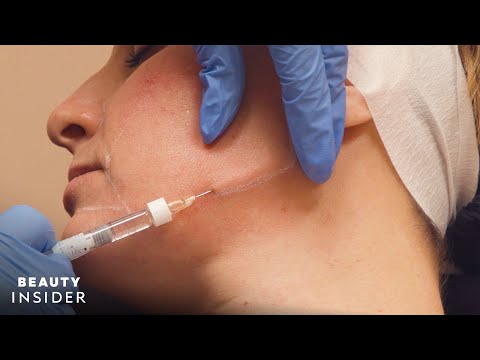 Most Popular Semi-Invasive Cosmetic Treatments In 2020